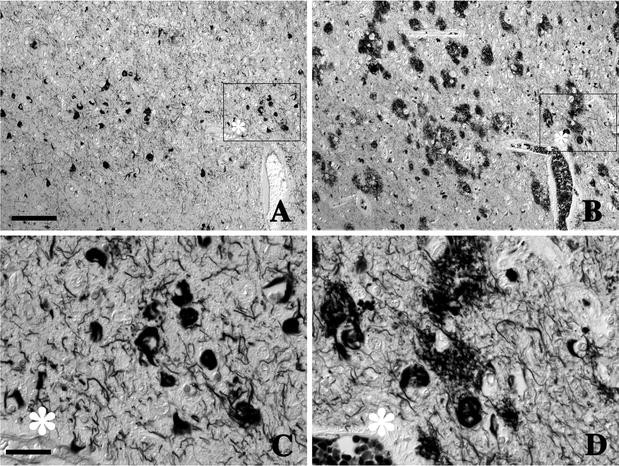 Silver stains distinguish tau-positive structures in corticobasal  degeneration/progressive supranuclear palsy and in Alzheimer's  disease—Comparison between Gallyas and Campbell-Switzer methods | Acta  Neuropathologica