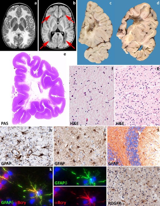 Reorganizations of latency structures within the white matter from