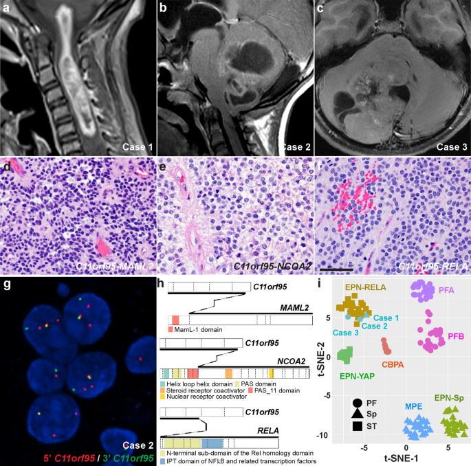 Stapes morphology (based on Hydropotes inermis NMB 9892). (A
