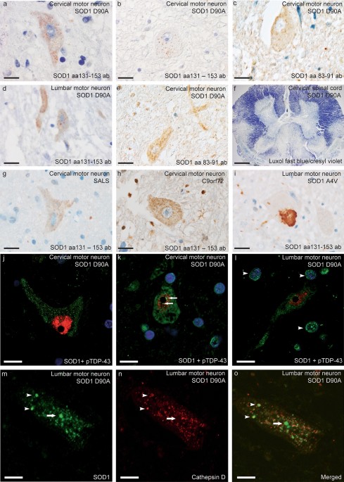 Widespread CNS pathology in amyotrophic lateral sclerosis homozygous for the D90A SOD1 mutation
