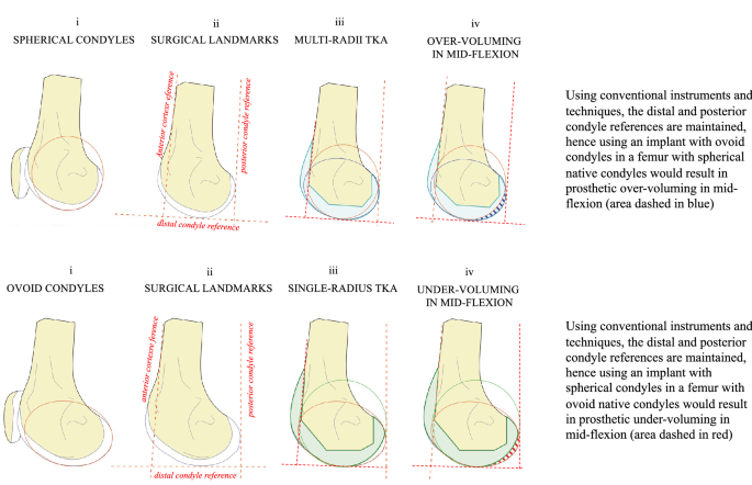 Pterodactyloidea indet. (SGO.PV.22913), distal portion of a right femur