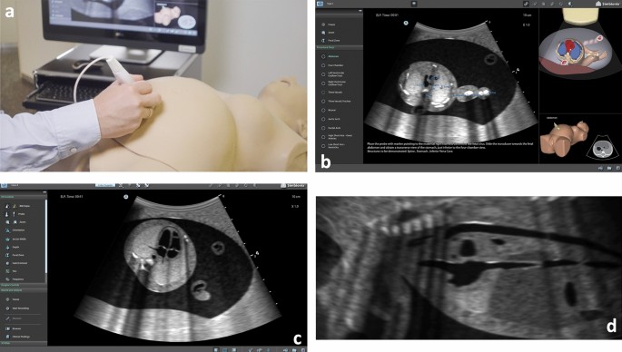 Ultrasound Simulator, Healthcare Simulation