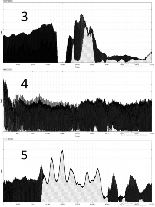 Efficacy of Doctorvox Voice Therapy Technique for Mutational