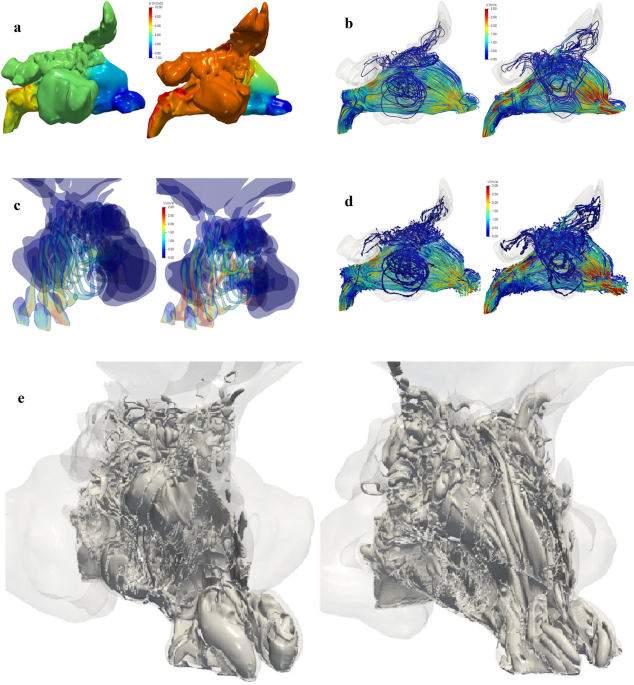 A - C F D: Applied Computational Fluid Dynamic Analysis of Thermal and  Fluid Flow over Space Shuttle or Rocket Nose Cone: Kanni Raj, A:  9781532817939: : Books