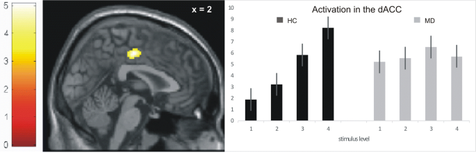 https://media.springernature.com/m685/springer-static/image/art%3A10.1007%2Fs00406-020-01123-0/MediaObjects/406_2020_1123_Fig1_HTML.png