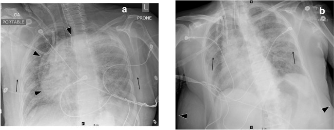 3 Ways Upright Cardiac Imaging Is Different From Supine