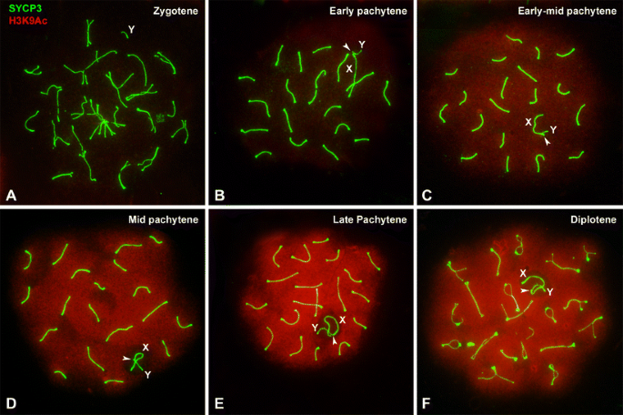 PDF) Lack of sex chromosome specific meiotic silencing in platypus