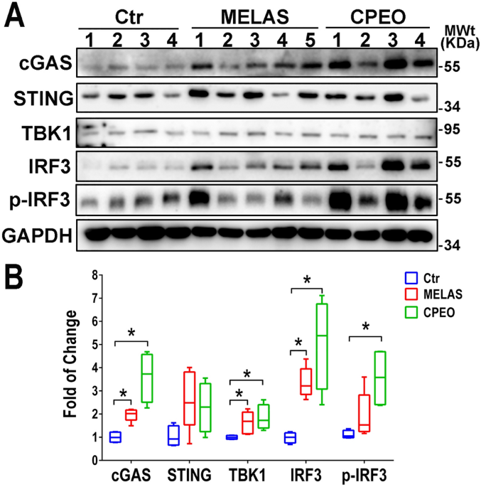 Circulating cell-free mtDNA release is associated with the activation of  cGAS-STING pathway and inflammation in mitochondrial diseases