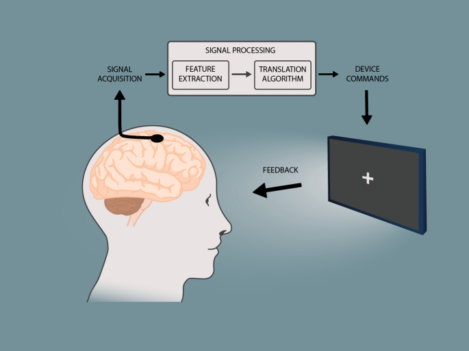 Towards clinical application of implantable brain–computer interfaces for people with late-stage ALS: medical and ethical considerations