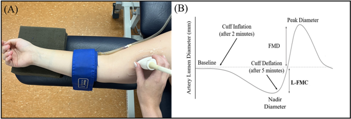 The average radial artery blood flow velocity (vrad.art.mean