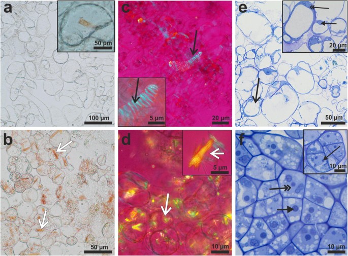 Unique chromoplast organisation and carotenoid gene expression in  carotenoid-rich carrot callus | Planta