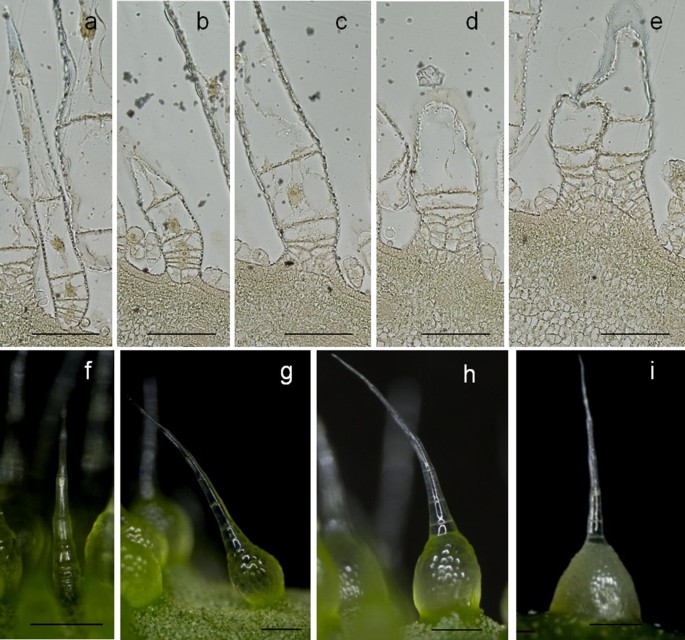 Classification of fruit trichomes in cucumber and effects of plant hormones  on type II fruit trichome development