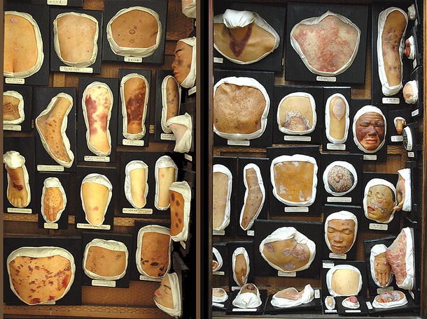 A moulage museum is not just a museum