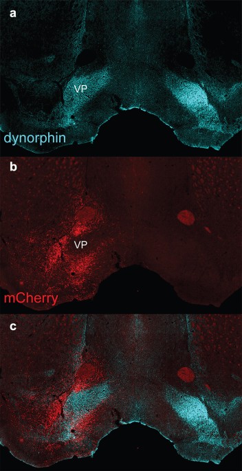 Basal forebrain subcortical projections