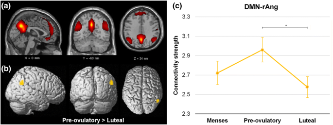 Human menstrual cycle variation in subcortical functional brain