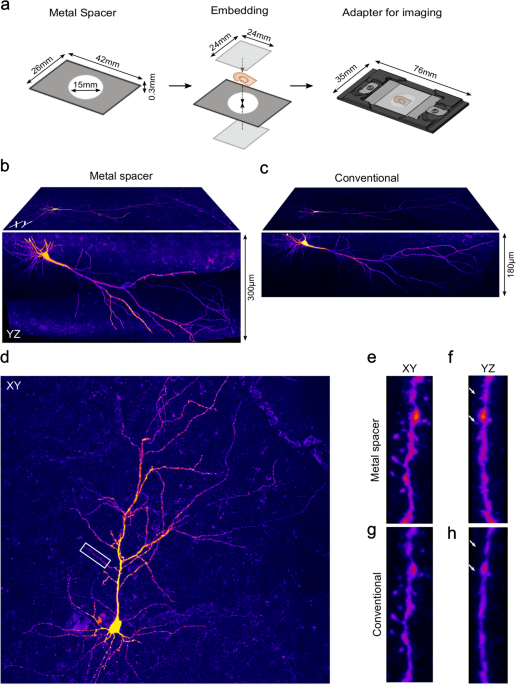 Minimizing shrinkage of acute brain slices using metal spacers during  histological embedding