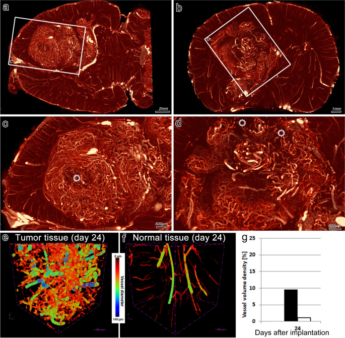 High-resolution micro-CT for 3D infarct characterization and segmentation  in mice stroke models