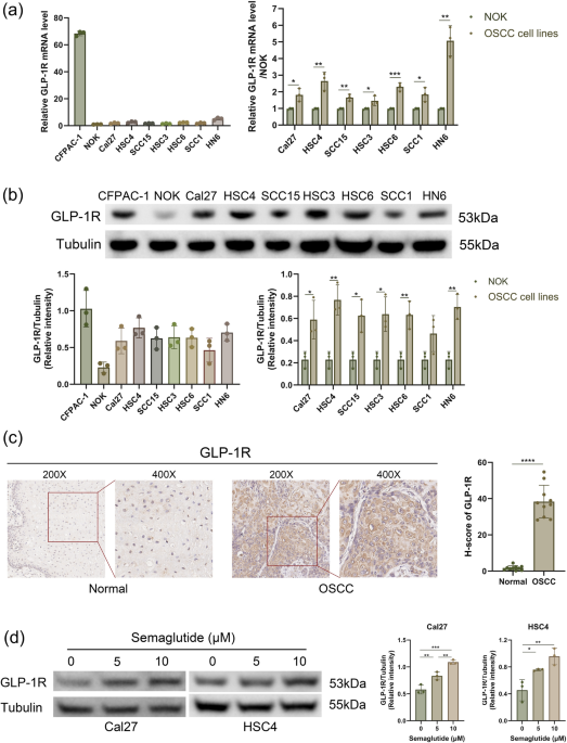 semaglutide and bladder cancer Semaglutide, a glucagon-like peptide-1 receptor agonist, inhibits oral  squamous cell carcinoma growth through P38 MAPK signaling pathway | Journal  of Cancer Research and Clinical Oncology