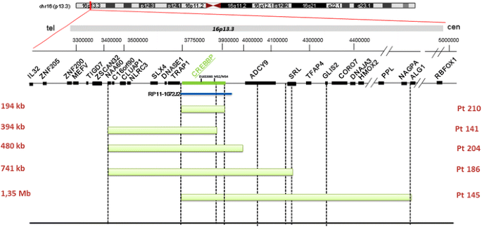 Novel cAMP binding protein-BP (CREBBP) mutation in a girl with Rubinstein- Taybi syndrome, GH deficiency, Arnold Chiari malformation and pituitary  hypoplasia – topic of research paper in Clinical medicine. Download  scholarly article PDF