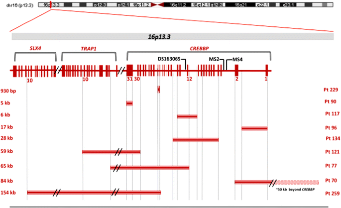 A novel CREBBP mutation and its phenotype in a case of Rubinstein