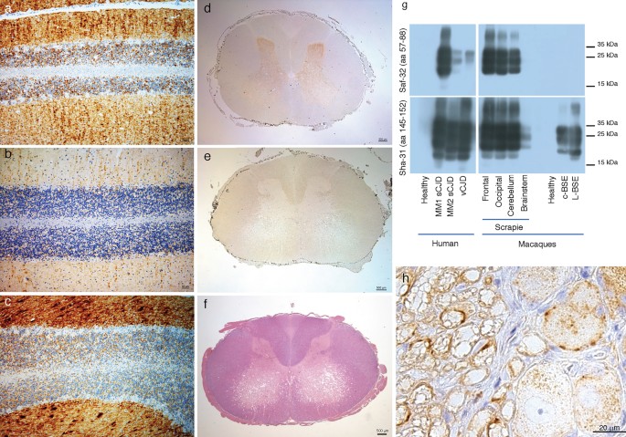 Detection of Prions in a Cadaver for Anatomical Practice