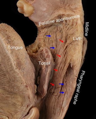 Anatomical Considerations of the Longitudinal Pharyngeal Muscles in  Relation to their Function on the Internal Surface of Pharynx | Dysphagia