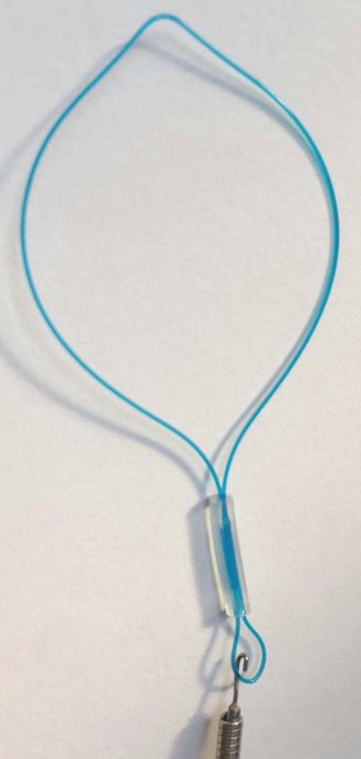 The Woggle Technique for Suture Closure of Hemodialysis Access  Catheterization Sites