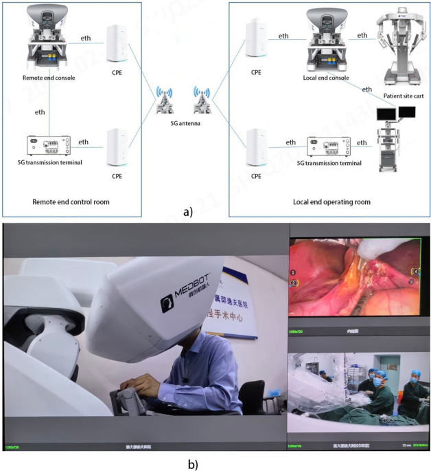 Application of 5G robotic telesurgery in urology: a multicenter study in the real world