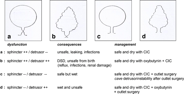 Results of Conservative and Surgical Management of the Neurogenic Bladder  in 160 Children