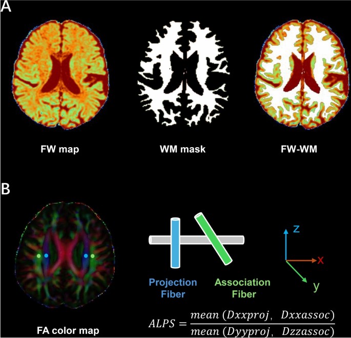 Multimodal MRI reveals glymphatic system activity associated with systemic inflammation and neuropsychiatric symptoms in Crohn’s disease
