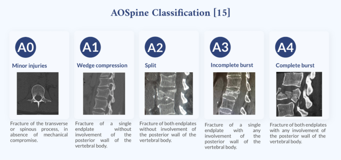 Spinal Bracing for Fractures - Spine Info