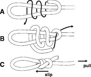 Easy slip-knot: a new simple tying technique for deep sutures