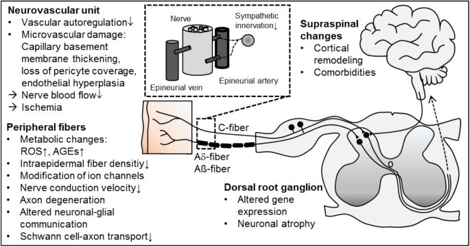 What Is Neurogenic Pain?, Risk Factors