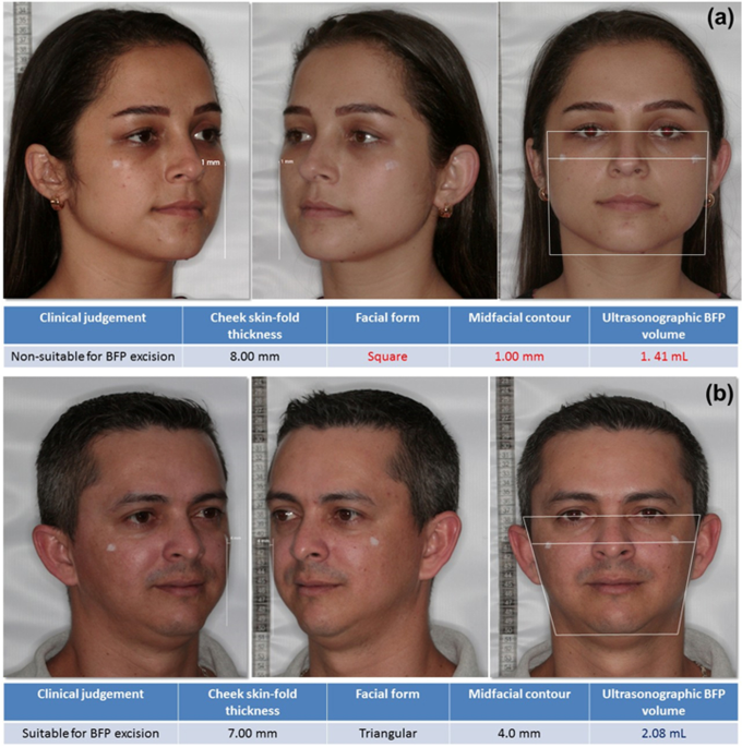 Assessment of clinical and ultrasonographic parameters as