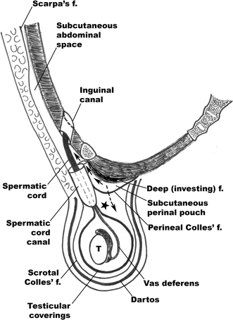 Inguinal Canal: Anatomy and Hernias | Concise Medical Knowledge