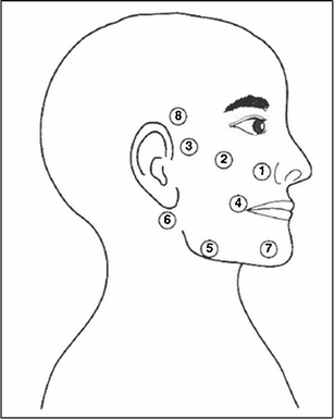 White Bell's Palsy Facial Palsy Splint, For Hospital, Size: Medium