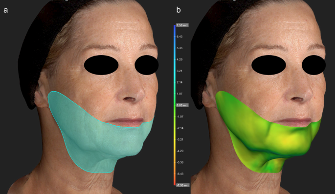 Physician reviewing published clinical study data on radiofrequency treatment outcomes