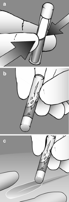 Using Dermabond for Wound Closure in Lumbar and Cervical