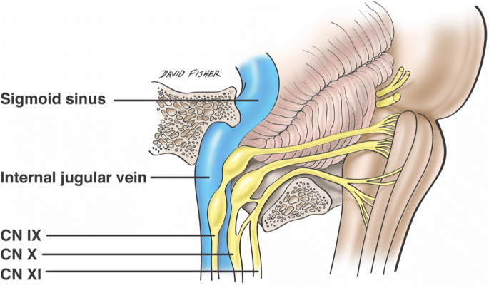 Lower cranial nerve syndromes: a review | Neurosurgical Review