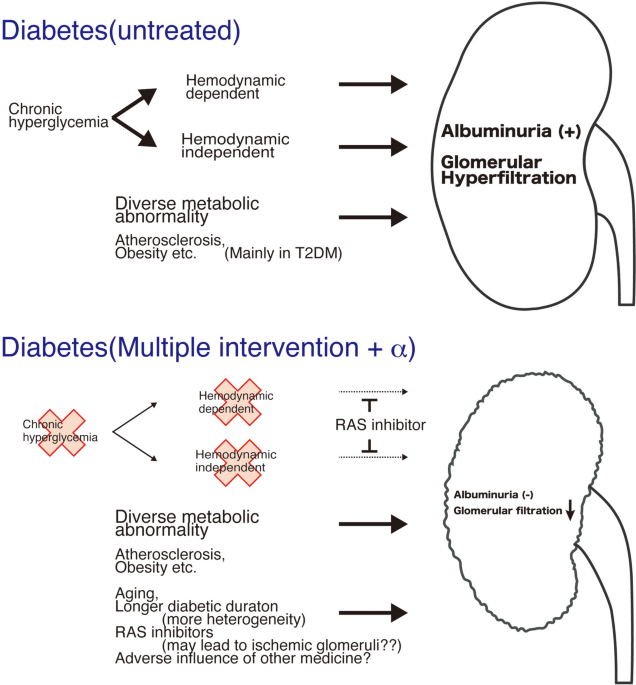 Diabetic kidney disease: the kidney disease relevant to individuals with diabetes