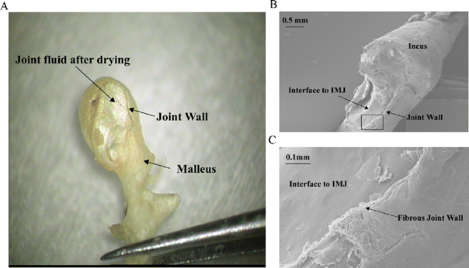 Malleus, incus and stapes.  Download Scientific Diagram