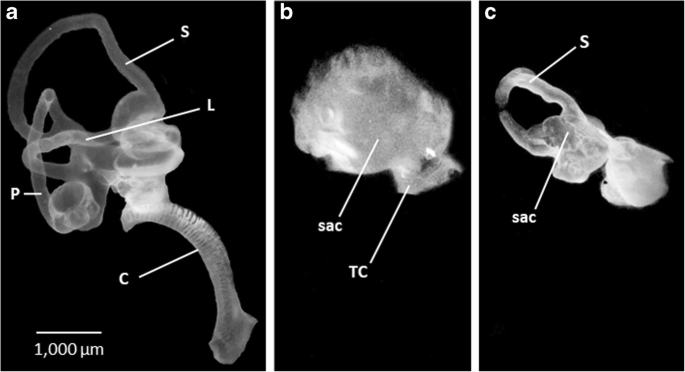 A New Model for Congenital Vestibular Disorders | Journal of the  Association for Research in Otolaryngology