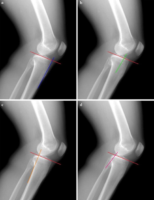 https://media.springernature.com/m685/springer-static/image/art%3A10.1007%2Fs10195-010-0120-0/MediaObjects/10195_2010_120_Fig6_HTML.jpg