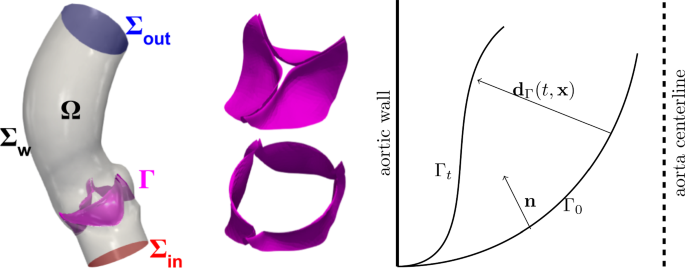 A reduced 3D-0D fluidstructure interaction model of the aortic valve that  includes leaflet curvature | Biomechanics and Modeling in Mechanobiology |  Springer Nature Link