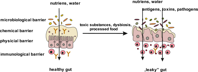 bpc-157 leaky gut or intestinal permeability Intestinal permeability disturbances: causes, diseases and therapy |  Clinical and Experimental Medicine