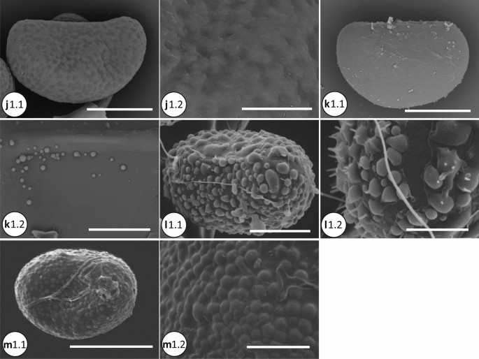 PDF) Spore Morphology and Ornamentation of Fern and Fern-Allies