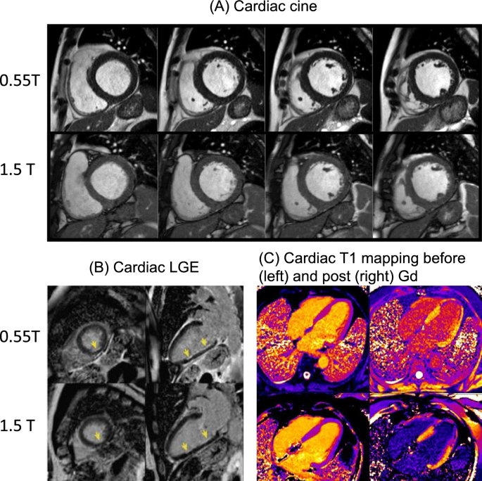 Journal of Magnetic Resonance Imaging: Vol 55, No 1