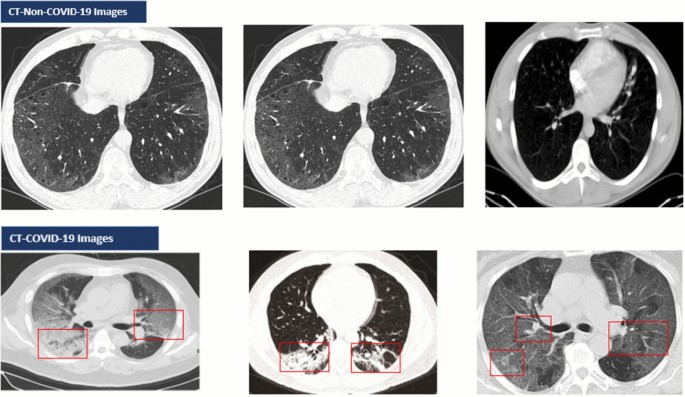 Multimodal medical AI – Google Research Blog