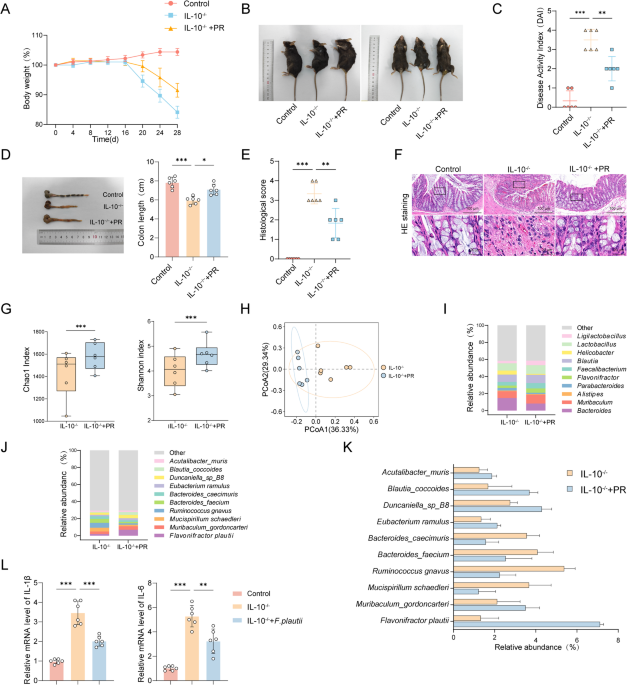 Microbiota-derived 4-HPAA alleviates Crohn’s disease by stabilizing SIRT1 and reprogramming macrophage immunometabolism