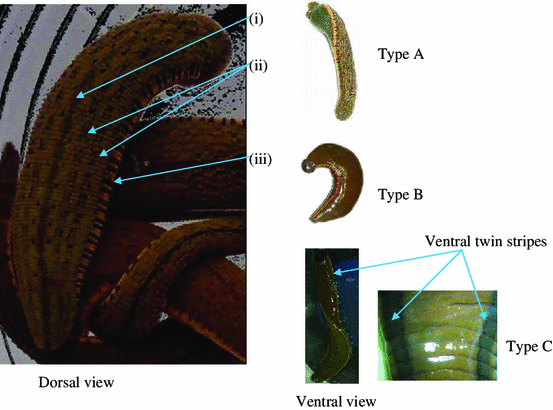 Morphological and Genetic Variations of the Freshwater Leech